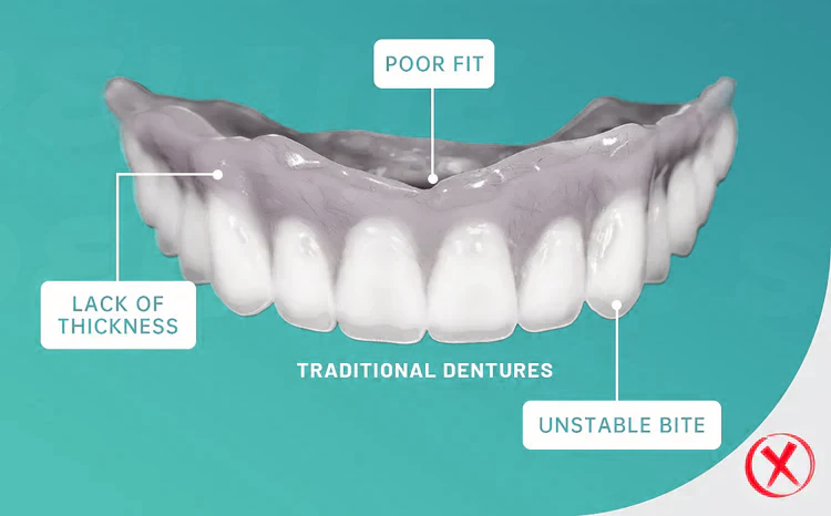 ROSOPL™ Custom-Fit Full Functional Dentures image ROSOPL™ Custom-Fit Full Functional Dentures