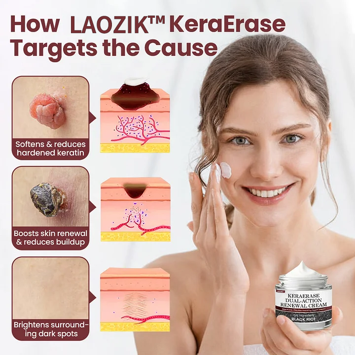 Laozik®KeraErase Dual-Action Renewal Cream