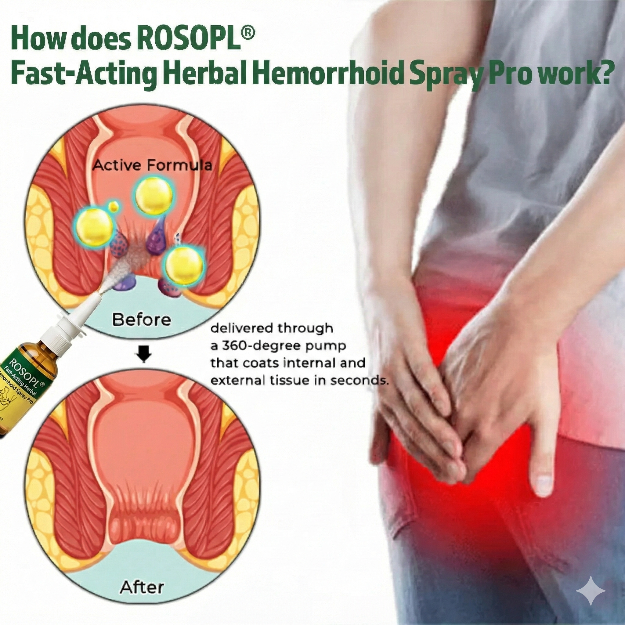 ROSOPL® Fast-Acting Herbal Hemorrhoid Spray Pro