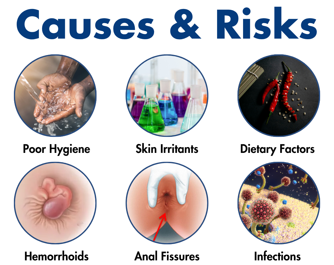 ROSOPL® Fast-Acting Herbal Hemorrhoid Spray Pro