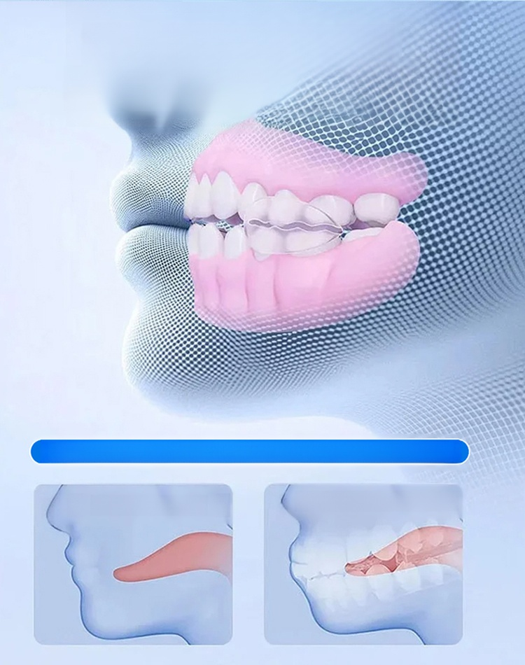 ✨Última generación de protectores dentales de silicona suave.No tóxico y sin zinc, se adapta cómodamente a las encías
