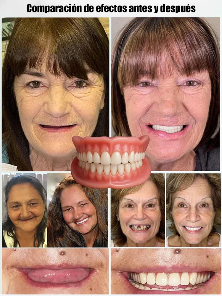 🇺🇸 Desarrollado por especialistas dentales de EE.UU. 😊 Se ajusta como dientes naturales – recupera tu sonrisa con confianza al instante🧳 Incluye estuche portátil – almacenamiento higiénico donde quiera que vayas