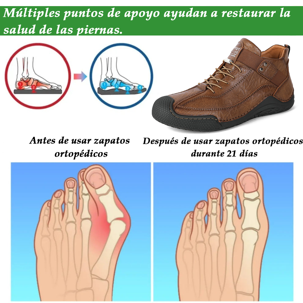 (🔥50% de descuento hoy - ¡No te lo pierdas!) - 🐂Zapatos de piel de becerro cómodos y elegantes 👞(antideslizante, soporte para el arco para aliviar el dolor)