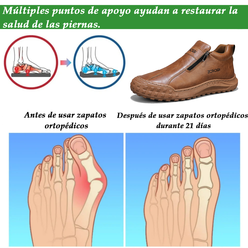 (🔥¡Último día! ¡50% de descuento! ¡No te lo pierdas!⏰)Botines casuales con cremallera lateral - Diseño ergonómico - Soporte de arco - Impermeable y antideslizante