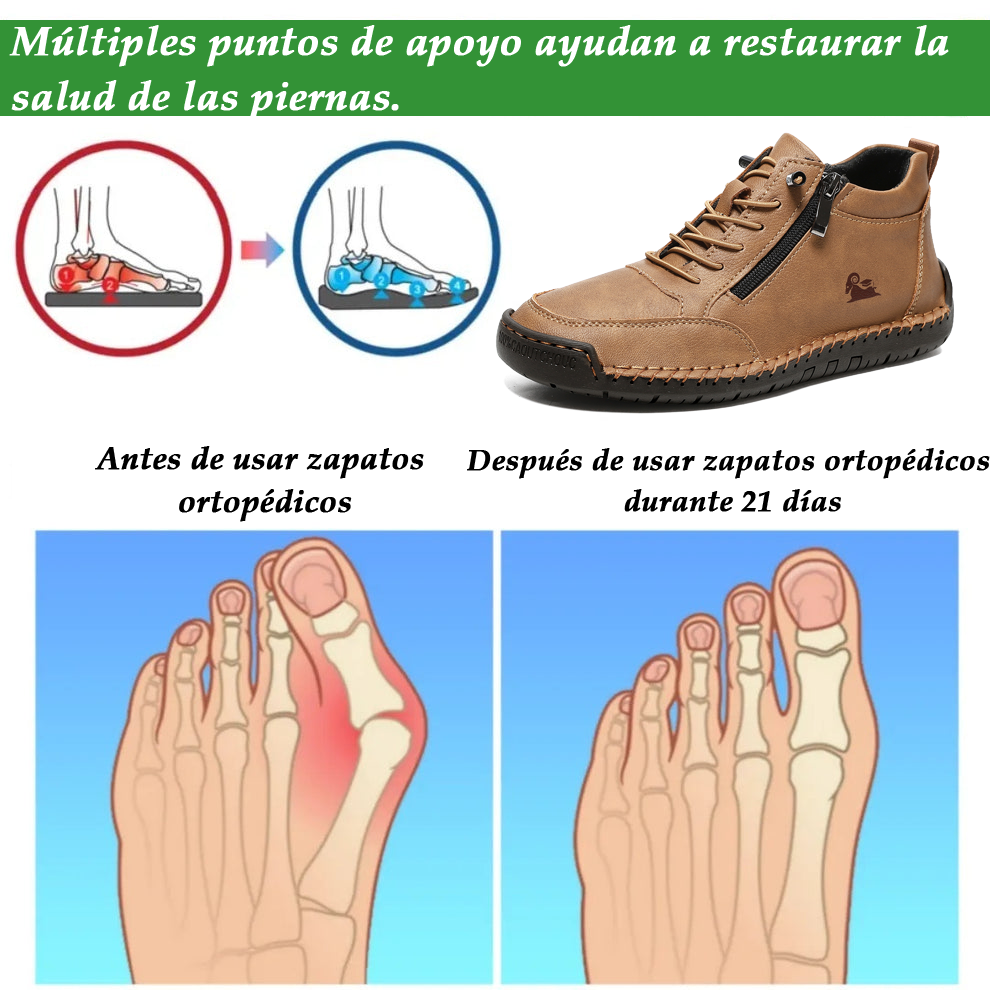 (🔥 50% de descuento - ¡No te lo pierdas!) Zapatos de piel de becerro seleccionados - Zapatos ortopédicos - 👞 - Duraderos, antideslizantes e impermeables (soporte de arco, alivio del dolor, unisex)