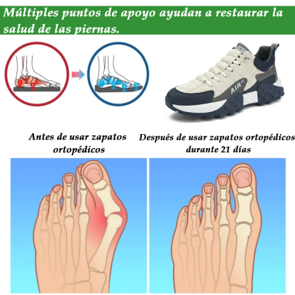 （⚡ ¡50% de Dto. SOLO HOY! ）Zapatillas Ergonómicas para Hombre: Camina Todo el Día Sin Dolor ni Fatiga - Proporciona soporte y anti-deslizamiento.