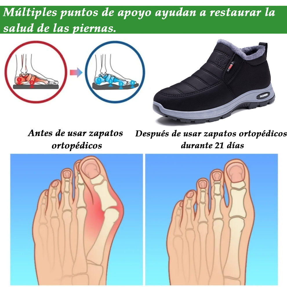 (🔥50% de descuento por tiempo limitado) Cómodos zapatos ortopédicos de invierno con forro de lana cálido, soporte para el arco plantar y alivio eficaz del dolor de espalda, articulaciones y pies. (Unisex)