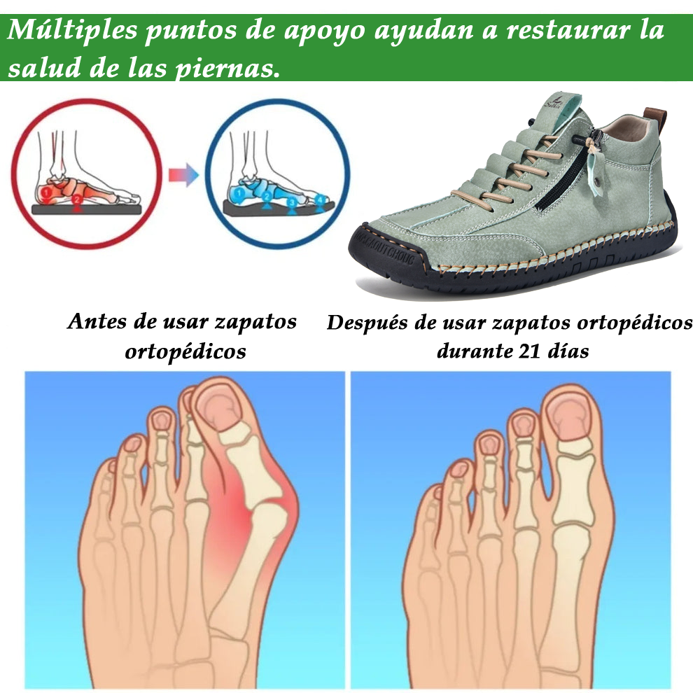 (🔥 ¡50% de descuento - No te lo pierdas!) Zapatos de piel "Cero Fatiga": Cremallera lateral, soporte plantar y suela antideslizante – su diseño ergonómico alivia la fatiga - unisex