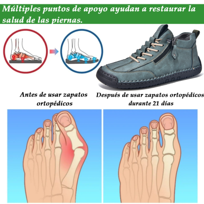 (🔥 ¡50% de descuento - No te lo pierdas!) Zapatos de piel "Cero Fatiga": Cremallera lateral, soporte plantar y suela antideslizante – su diseño ergonómico alivia la fatiga - unisex