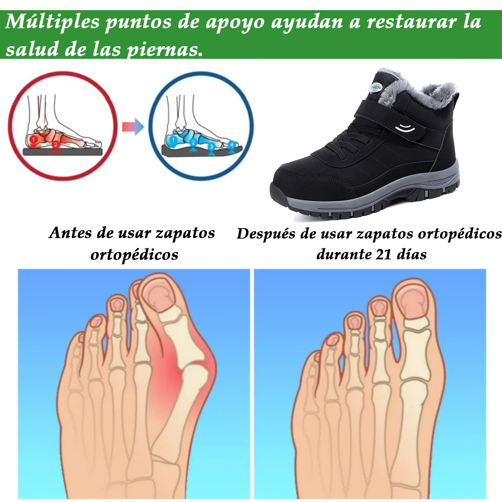 (🔥50% de descuento por tiempo limitado⏰) Zapatos ortopédicos de gamuza para invierno, suaves y cómodos, soporte de arco 🦶 para caminar con facilidad, impermeables y antideslizantes
