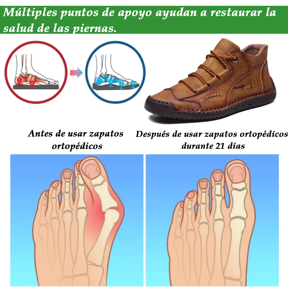 (🔥 50% de descuento - ¡No te lo pierdas!) Zapatos de piel de becerro premium - Zapatos ortopédicos - 👞 Impermeables y antideslizantes (soporte de arco para caminar más fácilmente)