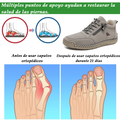 (🔥 50% de descuento - ¡No te lo pierdas!) Zapatos de piel de becerro seleccionados - Zapatos ortopédicos - 👞 - Duraderos, antideslizantes e impermeables (soporte de arco, alivio del dolor, unisex)