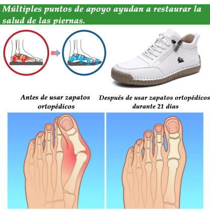 (🔥 50% de descuento - ¡No te lo pierdas!) Zapatos de piel de becerro seleccionados - Zapatos ortopédicos - 👞 - Duraderos, antideslizantes e impermeables (soporte de arco, alivio del dolor, unisex)