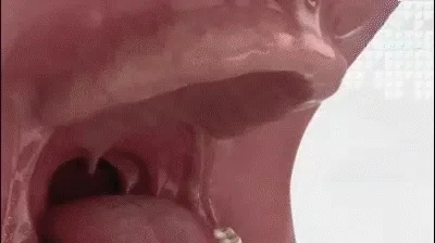 Smile Transformation