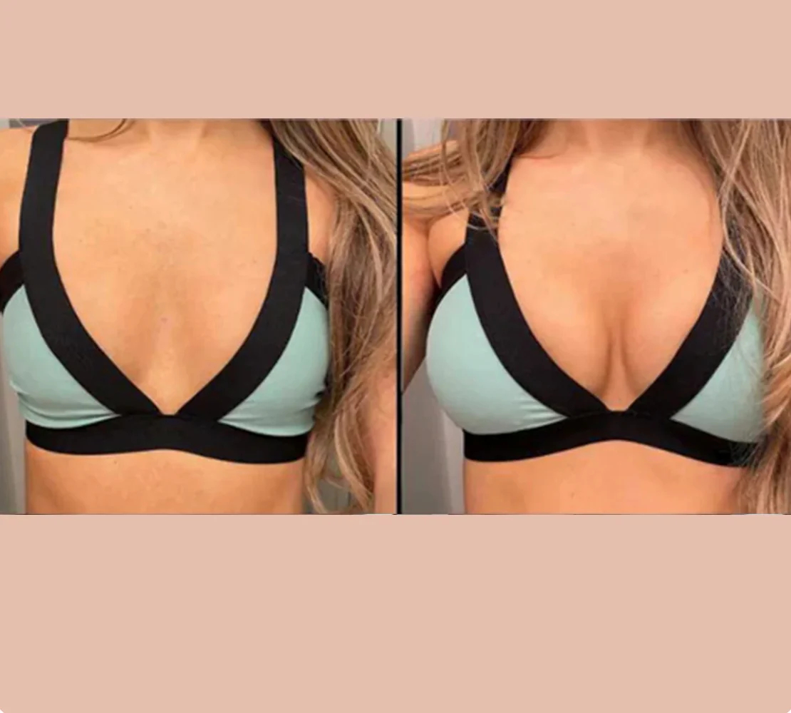 ULTRA LIFT STICKY BRA INSERTS