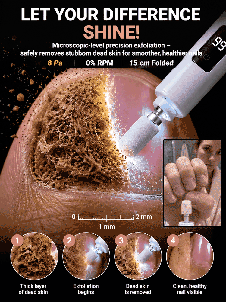 GET FLAWLESS NAILS IN 4 WEEKS! 🇩🇪 German-Engineered Pedicure Tool – FLASH SALE! 💥