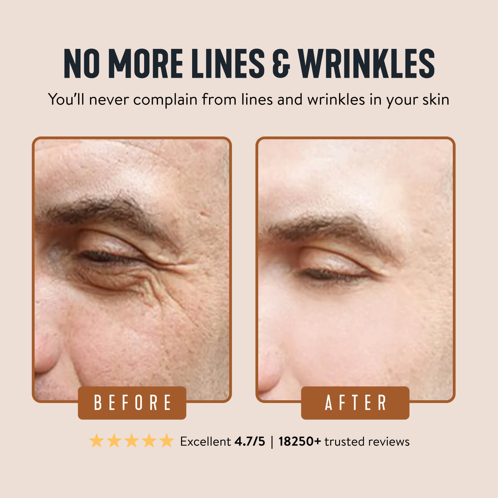 🥰Last Day Discount！Wrinkle Defense Tallow Balm