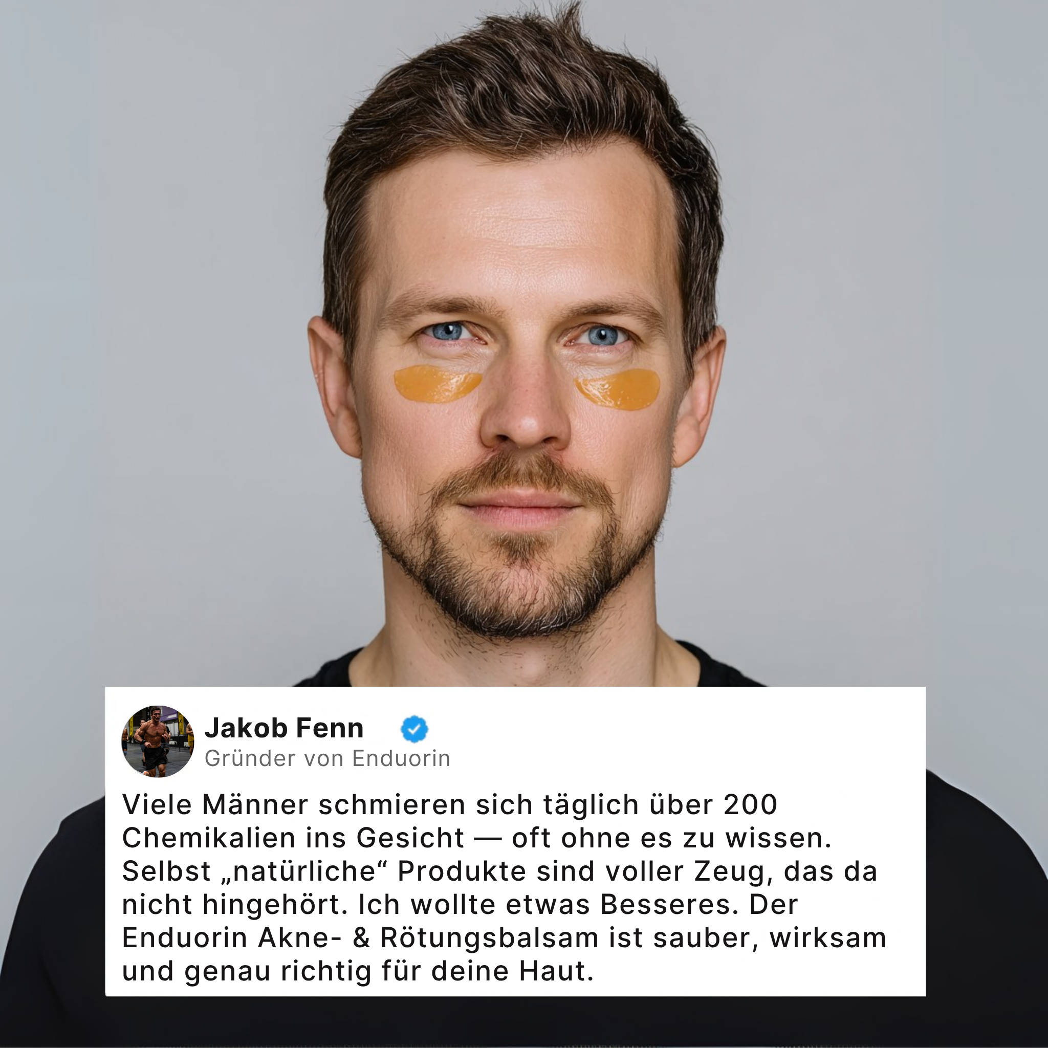 Rötungsstopp Akne Balsam