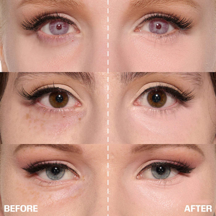 ✨ LAST DAY BUY 1 GET 1 FREE✨Cemenrete Calcium Dark Spot Eye Cream | Dark Circle, Anti-aging, Sagging, Elasticity