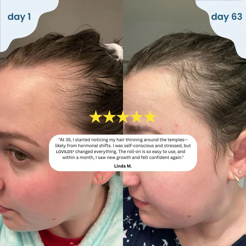 Nodiinfuse@ Hair GrowthRoll-On Serum