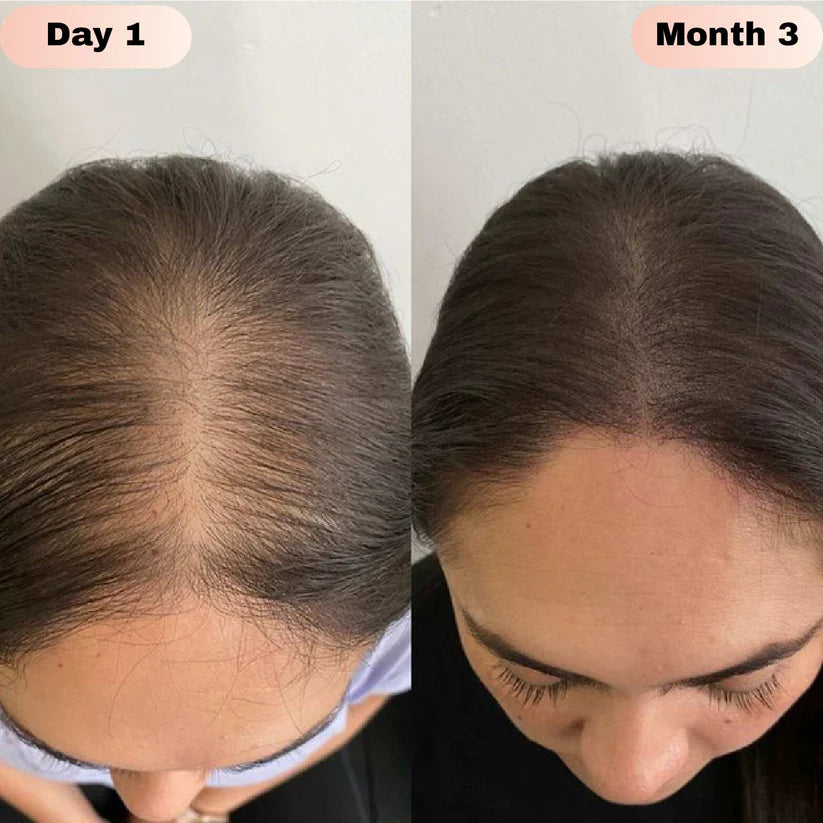 Nodiinfuse@ Hair GrowthRoll-On Serum