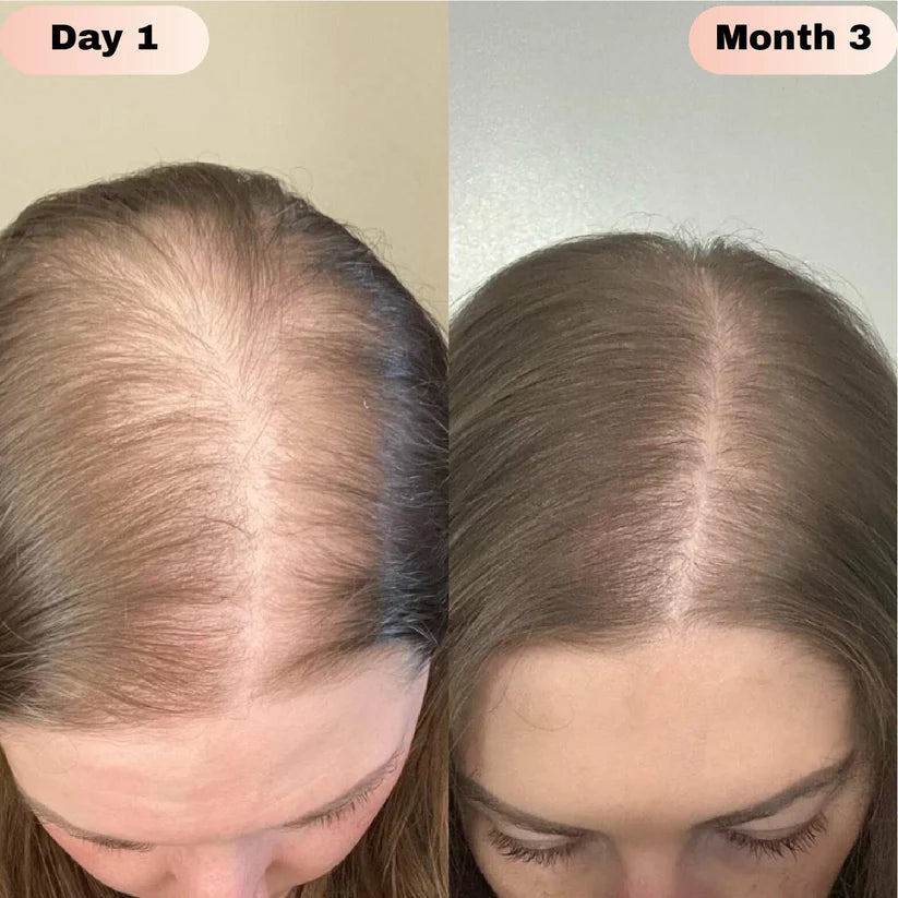 Nodiinfuse@ Hair GrowthRoll-On Serum