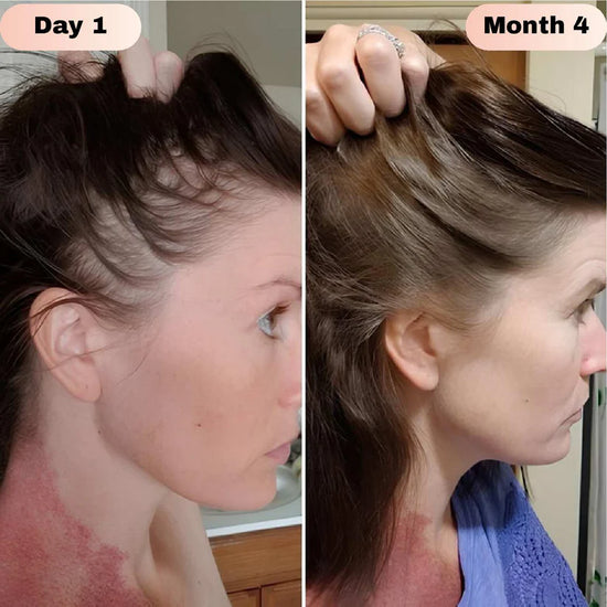 Nodiinfuse@ Hair GrowthRoll-On Serum