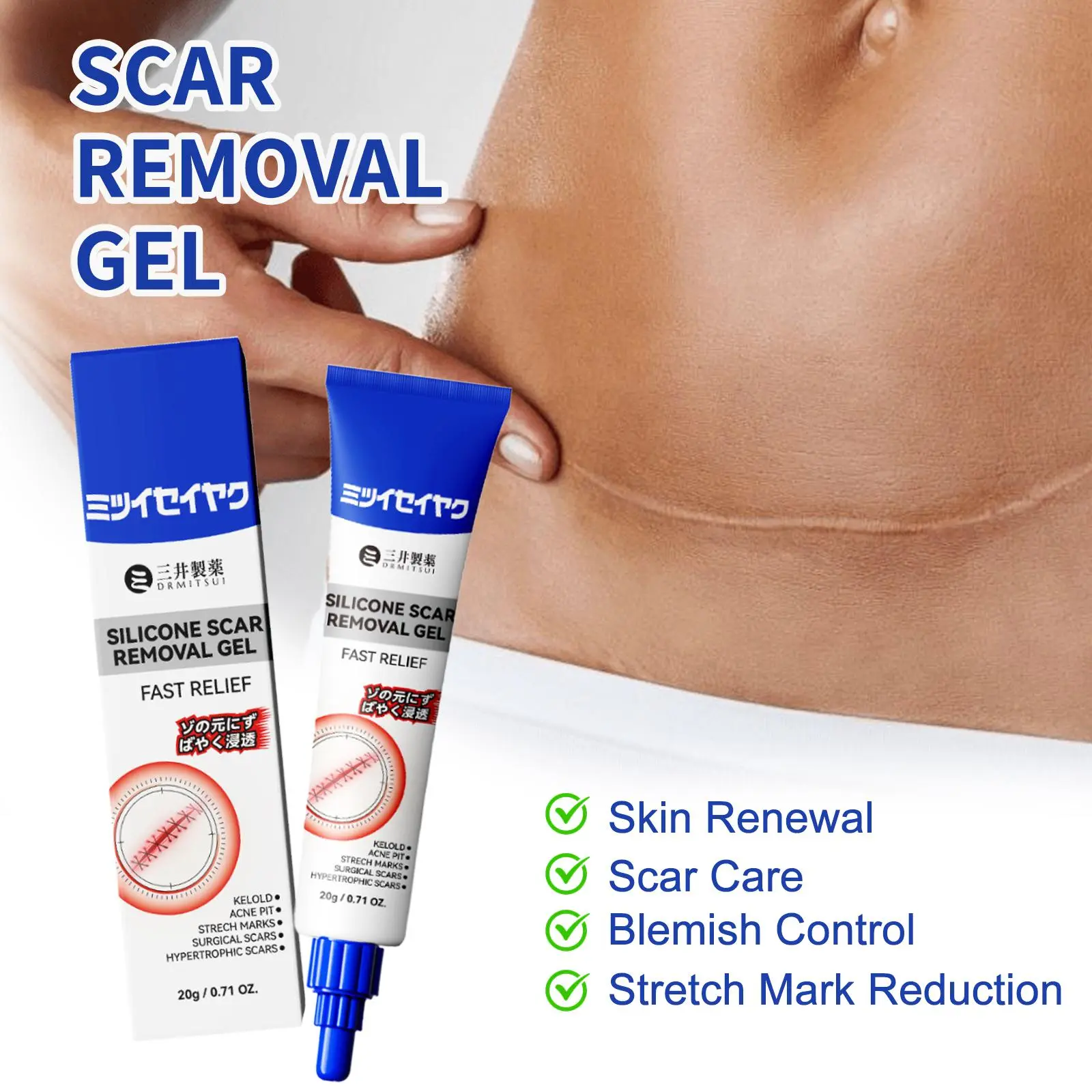 🔥Last Day 50% Off 🔥 Advanced Silicone Scar & Wrinkle Smoothing Gel