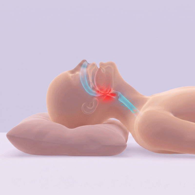 Motion-Guiding Knee Stabilizer