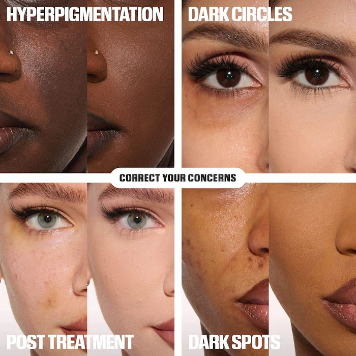 ✨ LAST DAY BUY 1 GET 1 FREE✨Cemenrete Calcium Dark Spot Eye Cream | Dark Circle, Anti-aging, Sagging, Elasticity