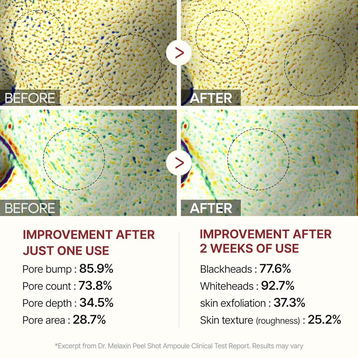 🏆Flash Sale⚡ Rice Peel Glow Serum Ampoule