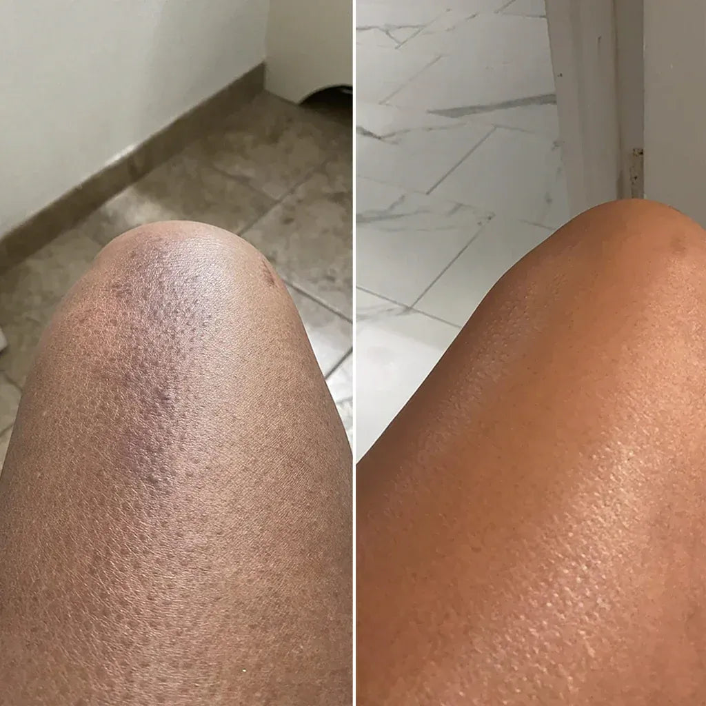 Peel Shot Keratin Care Kojic Acid Turmeric Spray