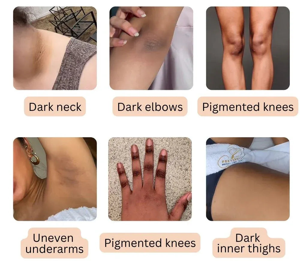 Peel Shot Keratin Care Kojic Acid Turmeric Spray