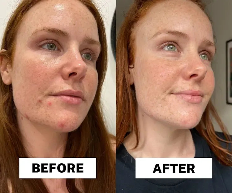 Peel Shot Keratin Care Kojic Acid Turmeric Spray