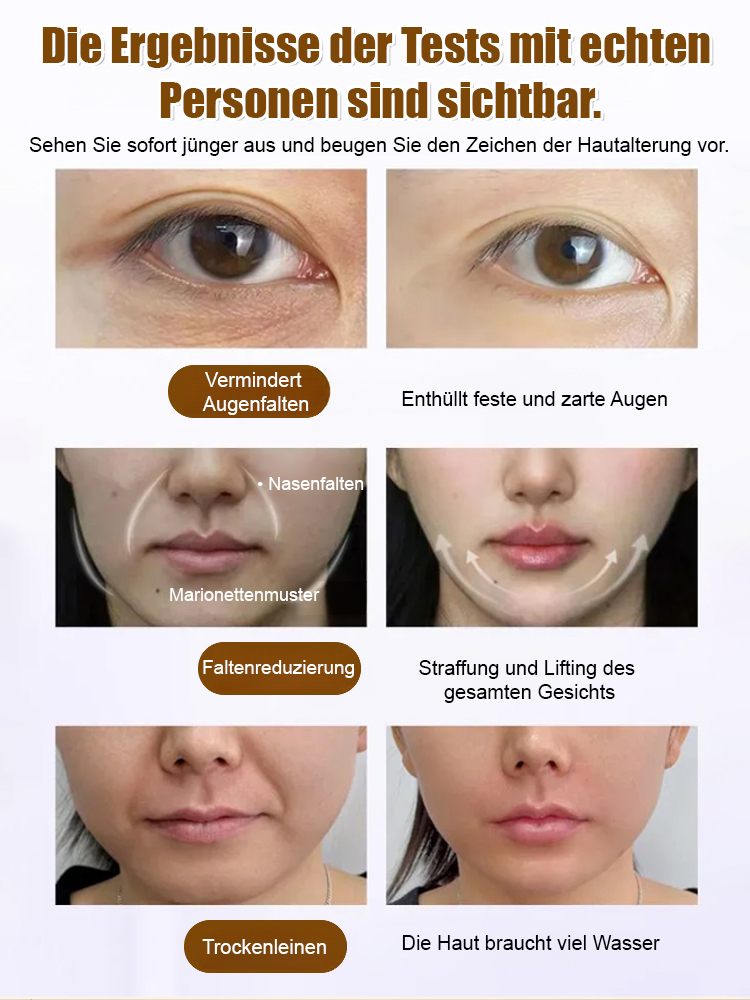 Zellrekombinations-Kollagen-Serum