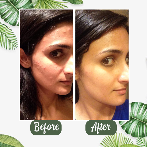 Natural Green Tea Clay Stick– Clears Acne & Refines Pores🌿