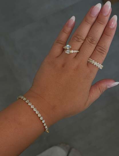 Gold Eterna Sparkle Set