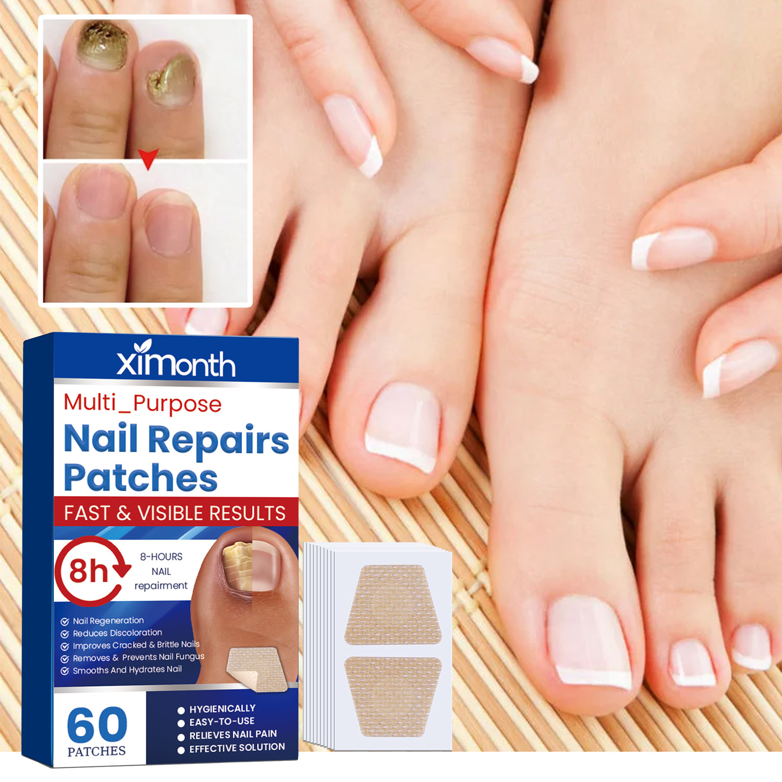 Fungus Nail Repair Patches 60pcs Ximonth®
