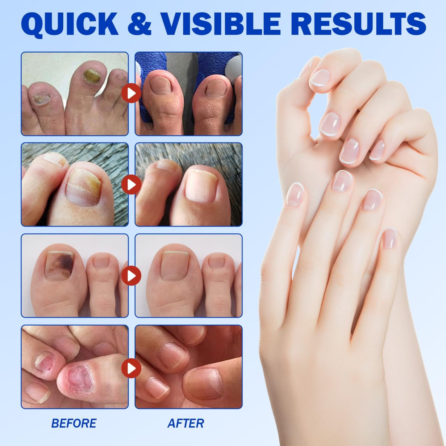 Fungus Nail Repair Patches 60pcs Ximonth®