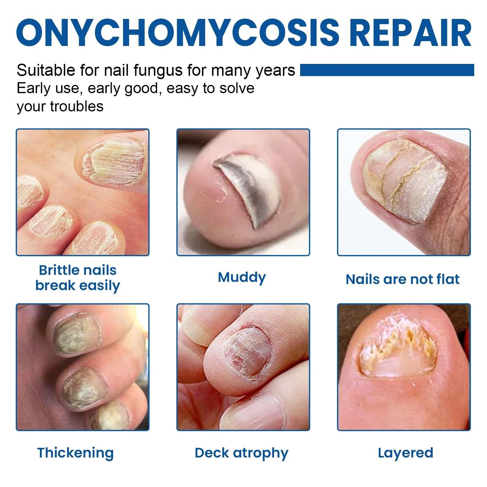 Fungus Nail Repair Patches 60pcs Ximonth®