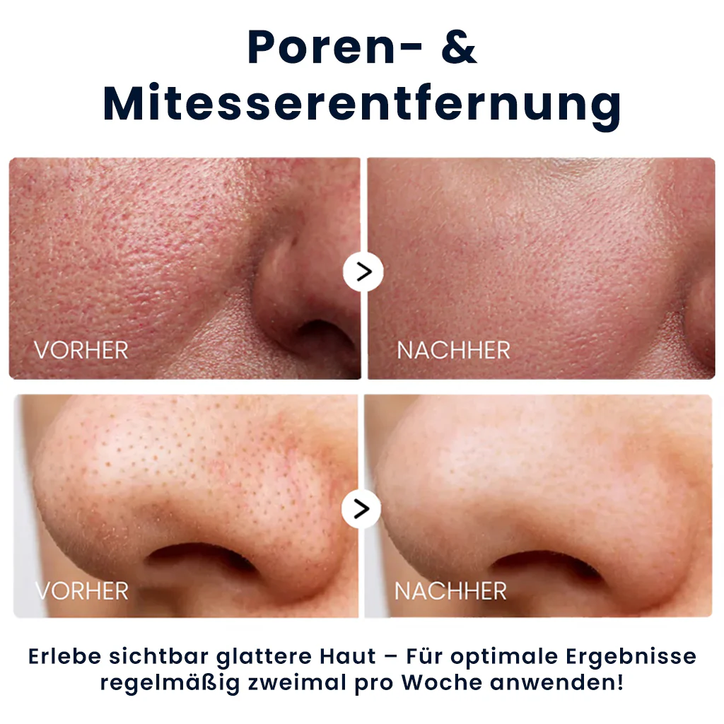 Dr. Melaxin – Reis-Peel-Shot-Duo für Glow & verfeinerte Hauttextur | 1+1 GRATIS