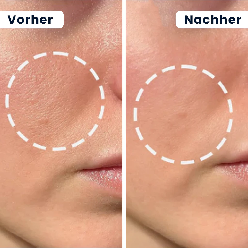 Dr. Melaxin – Reis-Peel-Shot-Duo für Glow & verfeinerte Hauttextur | 1+1 GRATIS