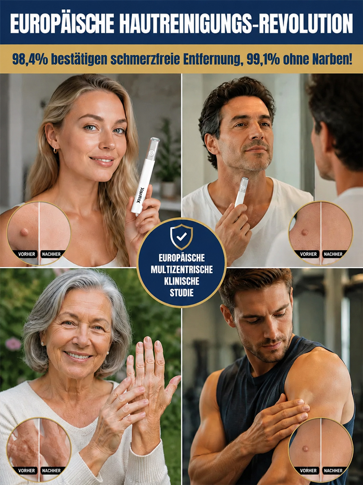 Warzen‑& Hautwucherungen‑Stift – Für glatte, makellose Haut zu Hause