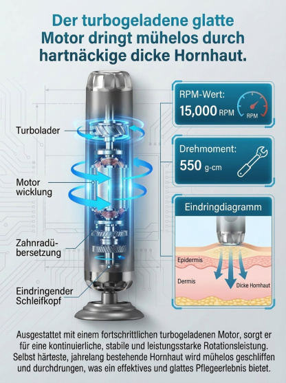 【5-Gang-Geschwindigkeitsregelung】Vollautomatischer elektrischer Hornhautentferner