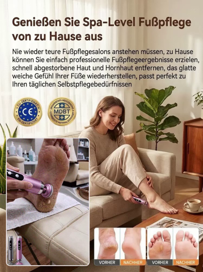 【5-Gang-Geschwindigkeitsregelung】Vollautomatischer elektrischer Hornhautentferner