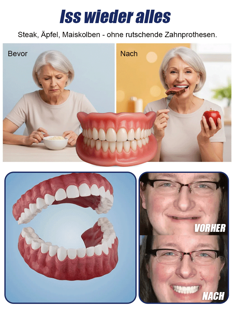 ✨Doppelt zertifizierte Selbstformende Zahnschalen, in 3 Minuten zuhause angepasst, medizinische Silikonqualität für präzise Bisspassung