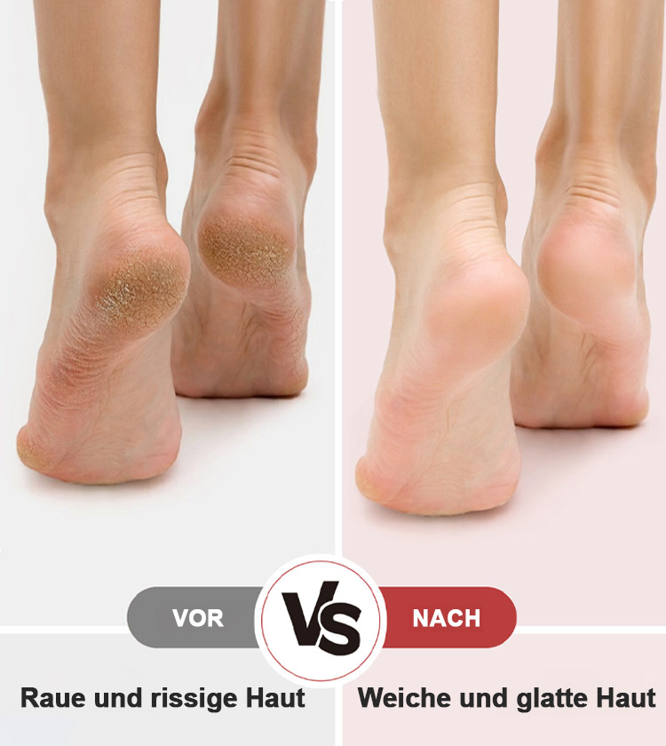 Elektrischer Fußfeilenentferner mit digitaler Anzeige für sofortige Entfernung von abgestorbener Hau