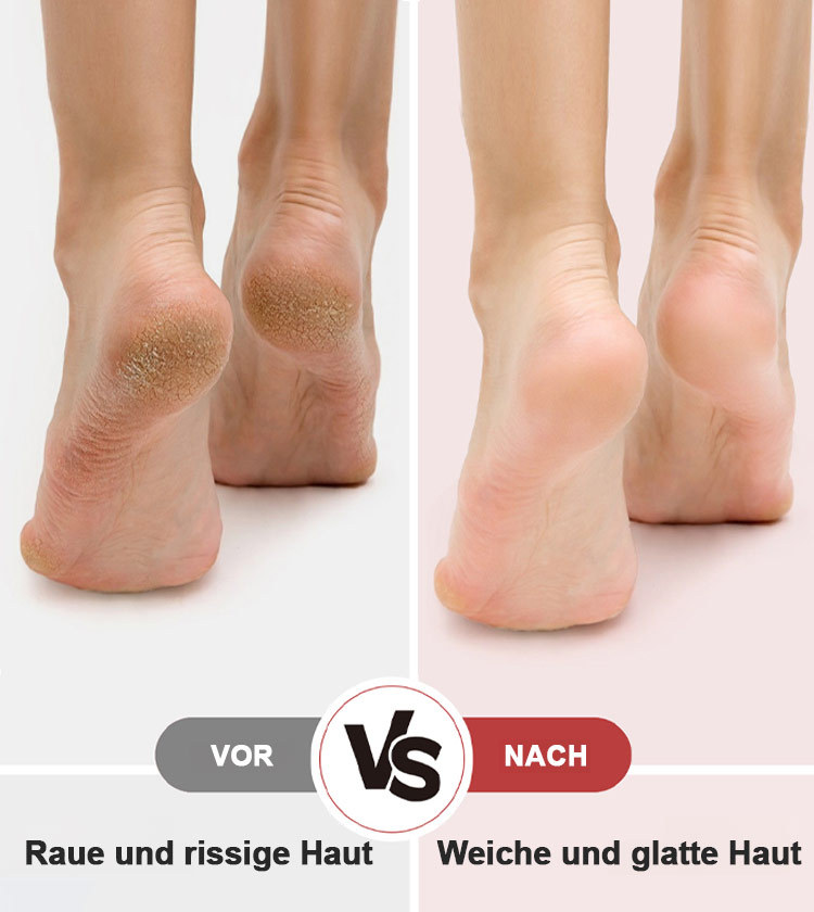 Elektrischer Fußfeilenentferner mit digitaler Anzeige für sofortige Entfernung von abgestorbener Hau