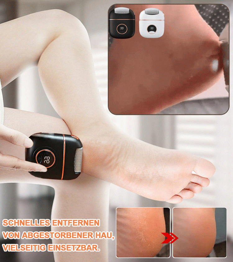 Elektrischer Fußfeilenentferner mit digitaler Anzeige für sofortige Entfernung von abgestorbener Hau