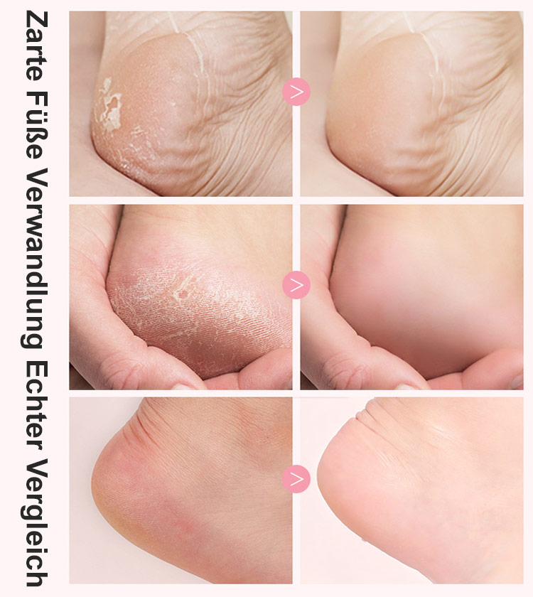 Elektrischer Fußfeilenentferner mit digitaler Anzeige für sofortige Entfernung von abgestorbener Hau